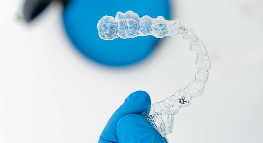Can Clear Aligners Help TMJ?, Root Cause Dental Group, London Ontario